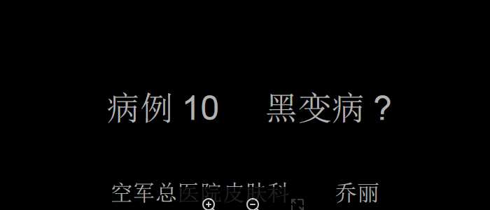 皮科病例PPT：病例10-乔丽.ppt