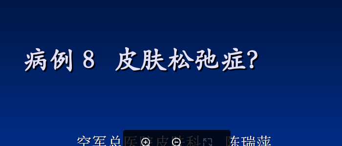 皮科病例PPT：病例8-陈瑞萍-皮肤松弛症.ppt