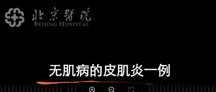 皮科病例PPT：17.北京医院无肌病的皮肌炎.ppt